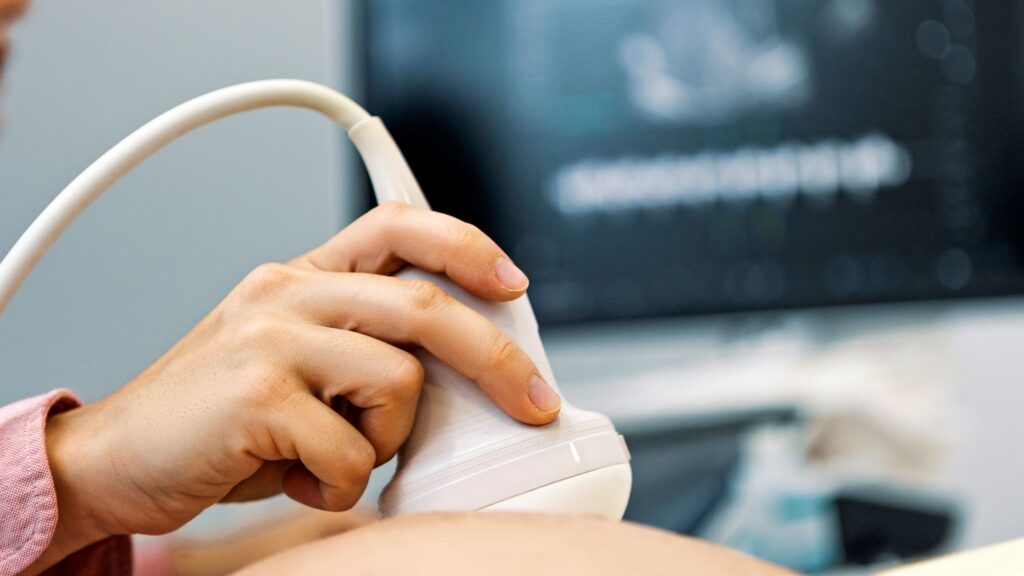 skynews-ultrasound-sonographer_7205262.jpg